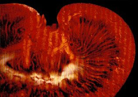 MICROFIL® injetion of a rat kidney